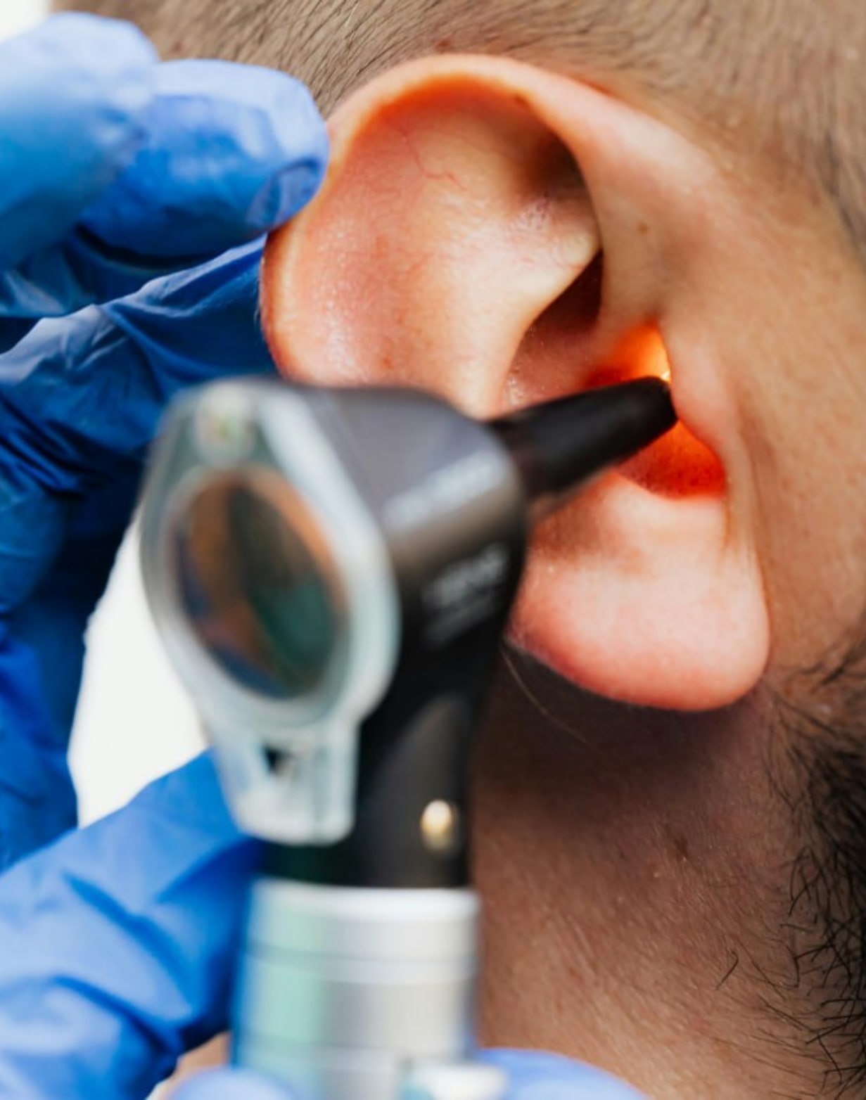 The Hidden Consequences of Untreated Hearing Loss