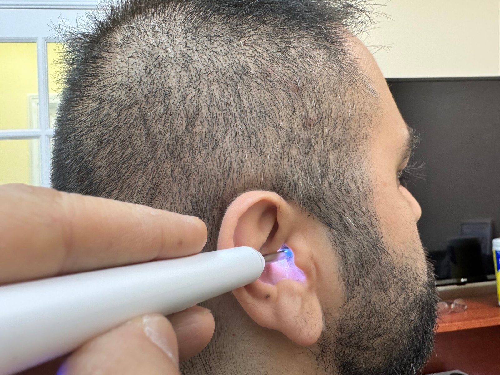 Earwax Removal Halifax